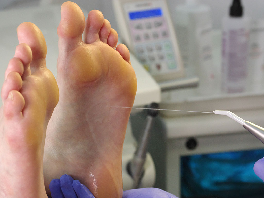 Podolog Kościerzyna Pedicure leczniczy